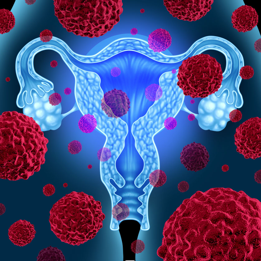 Cervix <a href='/cancer/'>Cancer</a>