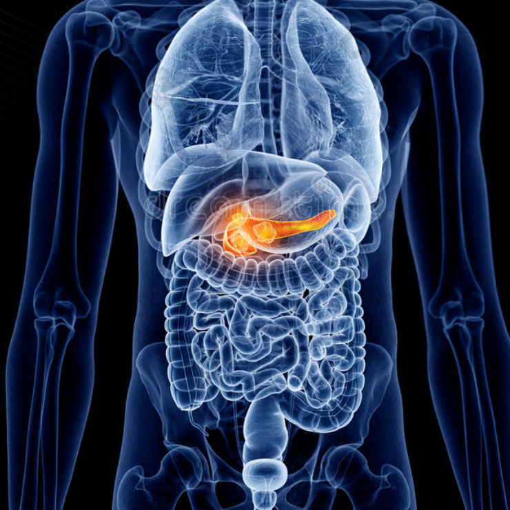 Pancreatic <a href='/cancer/'>Cancer</a>