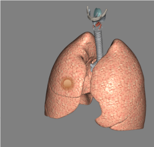 lungs