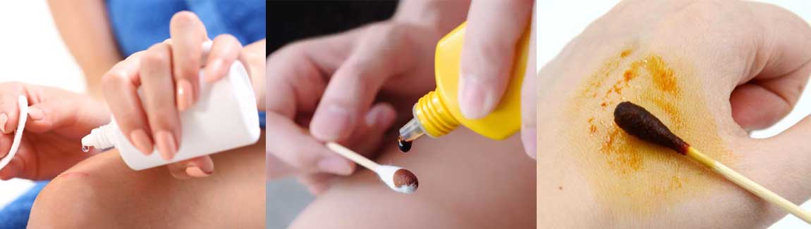 Octenidine-dihydrochloride-application